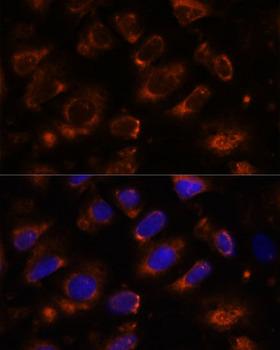TNM / Teneurin-1 Antibody - Immunofluorescence analysis of U-2OS cells using TENM1 Polyclonal Antibody at dilution of 1:100.Blue: DAPI for nuclear staining.