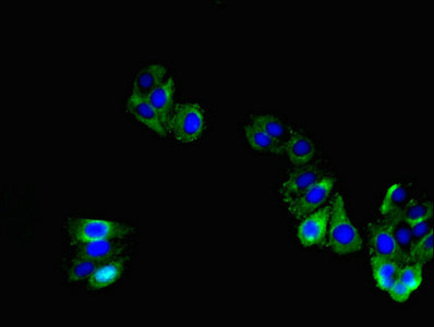 TNMD / Tenomodulin Antibody - Immunofluorescent analysis of HepG2 cells at a dilution of 1:100 and Alexa Fluor 488-congugated AffiniPure Goat Anti-Rabbit IgG(H+L)