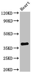 TNMD / Tenomodulin Antibody - Positive Western Blot detected in Mouse heart tissue. All lanes: TNMD antibody at 2.8 µg/ml Secondary Goat polyclonal to rabbit IgG at 1/50000 dilution. Predicted band size: 38, 24, 31 KDa. Observed band size: 38 KDa
