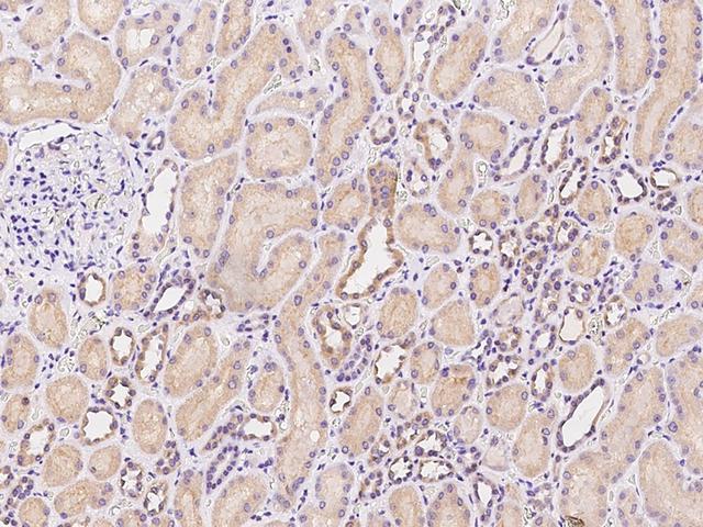 TNMD / Tenomodulin Antibody - Immunochemical staining of human TNMD in human kidney with rabbit polyclonal antibody at 1:100 dilution, formalin-fixed paraffin embedded sections.