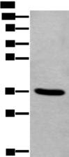 TNMD / Tenomodulin Antibody - Western blot analysis of Human fetal liver tissue lysate  using TNMD Polyclonal Antibody at dilution of 1:400