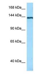 TNN / Tenascin N Antibody - TNN antibody Western Blot of RPMI-8226.  This image was taken for the unconjugated form of this product. Other forms have not been tested.