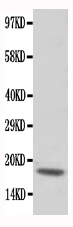 TNNC1 / Cardiac Troponin C Antibody - Anti-cardiac Troponin C antibody, Western blotting All lanes: Anti cardiac Troponin C at 0.5ug/ml WB: Rat Skeletal Muscle Tissue Lysate at 50ug Predicted bind size: 18KD Observed bind size: 18KD