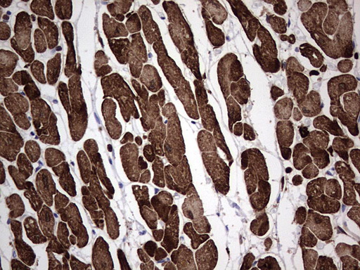 TNNC1 / Cardiac Troponin C Antibody - Immunohistochemical staining of paraffin-embedded Human adult heart tissue using anti-TNNC1 Mouse monoclonal antibody.  heat-induced epitope retrieval by 1 mM EDTA in 10mM Tris, pH8.5, 120C for 3min)