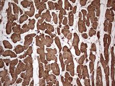 TNNC1 / Cardiac Troponin C Antibody - IHC of paraffin-embedded Human adult heart tissue using anti-TNNC1 mouse monoclonal antibody. (Heat-induced epitope retrieval by 1 mM EDTA in 10mM Tris, pH8.5, 120°C for 3min).