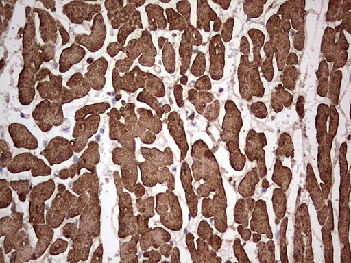 TNNC1 / Cardiac Troponin C Antibody - IHC of paraffin-embedded Human adult heart tissue using anti-TNNC1 mouse monoclonal antibody. (Heat-induced epitope retrieval by 1 mM EDTA in 10mM Tris, pH8.5, 120°C for 3min).