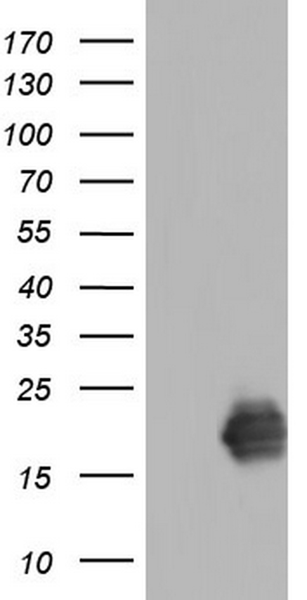 TNNC1 / Cardiac Troponin C Antibody - HEK293T cells were transfected with the pCMV6-ENTRY control. (Left lane) or pCMV6-ENTRY TNNC1. (Right lane) cDNA for 48 hrs and lysed. Equivalent amounts of cell lysates. (5 ug per lane) were separated by SDS-PAGE and immunoblotted with anti-TNNC1.