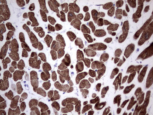 TNNC1 / Cardiac Troponin C Antibody - Immunohistochemical staining of paraffin-embedded Human adult heart tissue using anti-TNNC1 mouse monoclonal antibody. (Heat-induced epitope retrieval by 1 mM EDTA in 10mM Tris, pH8.5, 120C for 3min,