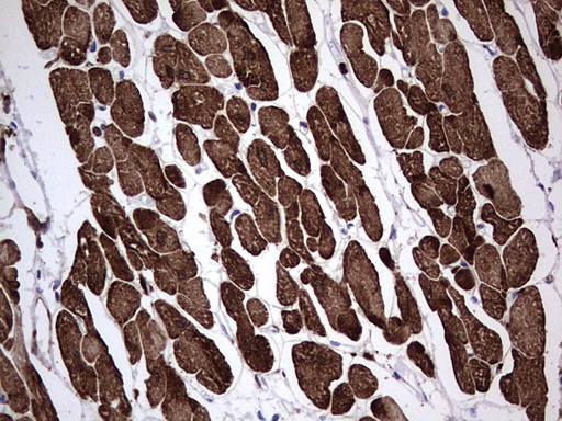 TNNC1 / Cardiac Troponin C Antibody - Immunohistochemical staining of paraffin-embedded Human adult heart tissue using anti-TNNC1 Mouse monoclonal antibody.  heat-induced epitope retrieval by 1 mM EDTA in 10mM Tris, pH8.5, 120C for 3min)