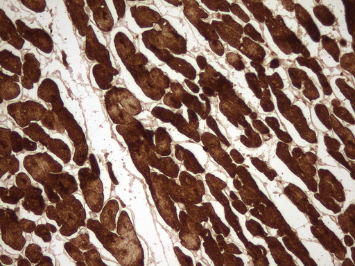 TNNC1 / Cardiac Troponin C Antibody - Immunohistochemical staining of paraffin-embedded Human adult heart tissue using anti-TNNC1 mouse monoclonal antibody. (Heat-induced epitope retrieval by 1mM EDTA in 10mM Tris buffer. (pH8.0) at 120C for 3 min. (1:200)