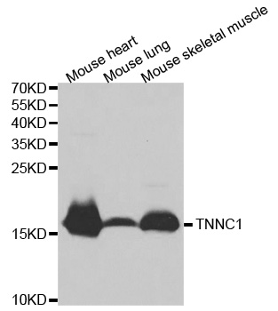 TNNC1 / Cardiac Troponin C Antibody - Western blot analysis of extracts of various cell lines.