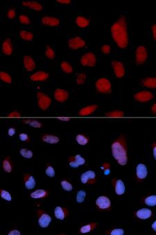 TNNC1 / Cardiac Troponin C Antibody - Immunofluorescence analysis of U2OS cells.