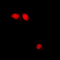 TNNC1 / Cardiac Troponin C Antibody - Immunofluorescent analysis of Troponin C staining in U2OS cells. Formalin-fixed cells were permeabilized with 0.1% Triton X-100 in TBS for 5-10 minutes and blocked with 3% BSA-PBS for 30 minutes at room temperature. Cells were probed with the primary antibody in 3% BSA-PBS and incubated overnight at 4 deg C in a humidified chamber. Cells were washed with PBST and incubated with a DyLight 594-conjugated secondary antibody (red) in PBS at room temperature in the dark.