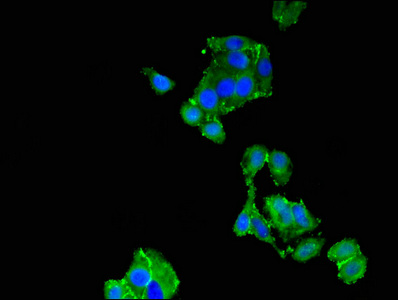 TNNC1 / Cardiac Troponin C Antibody - Immunofluorescent analysis of HepG2 cells at a dilution of 1:100 and Alexa Fluor 488-congugated AffiniPure Goat Anti-Rabbit IgG(H+L)