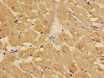 TNNC1 / Cardiac Troponin C Antibody - Immunohistochemistry image of paraffin-embedded human heart tissue at a dilution of 1:100