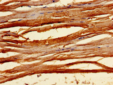 TNNC1 / Cardiac Troponin C Antibody - Immunohistochemistry image of paraffin-embedded human skeletal muscle tissue at a dilution of 1:100