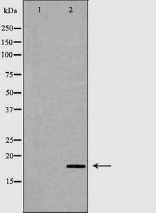 TNNC1 / Cardiac Troponin C Antibody - Western blot analysis of extracts of human stomach tissue using TNNC1 antibody. The lane on the left is treated with the antigen-specific peptide.
