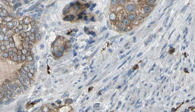 TNNC1 / Cardiac Troponin C Antibody - 1:100 staining human prostate tissue by IHC-P. The sample was formaldehyde fixed and a heat mediated antigen retrieval step in citrate buffer was performed. The sample was then blocked and incubated with the antibody for 1.5 hours at 22°C. An HRP conjugated goat anti-rabbit antibody was used as the secondary.
