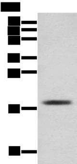 TNNC1 / Cardiac Troponin C Antibody - Western blot analysis of Mouse skeletal muscle tissue  using TNNC1 Polyclonal Antibody at dilution of 1:250