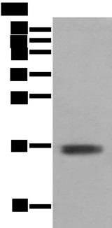 TNNC1 / Cardiac Troponin C Antibody - Western blot analysis of Mouse skeletal muscle tissue  using TNNC1 Polyclonal Antibody at dilution of 1:400