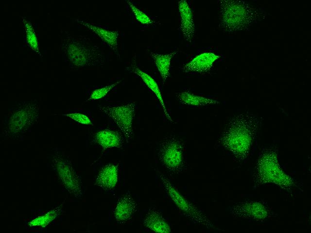 TNNC1 / Cardiac Troponin C Antibody - Immunofluorescence staining of TNNC1 in Hela cells. Cells were fixed with 4% PFA, permeabilzed with 0.1% Triton X-100 in PBS, blocked with 10% serum, and incubated with rabbit anti-Human TNNC1 polyclonal antibody (dilution ratio 1:1000) at 4°C overnight. Then cells were stained with the Alexa Fluor 488-conjugated Goat Anti-rabbit IgG secondary antibody (green). Positive staining was localized to cytoplasm and nucleus.