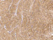 TNNC1 / Cardiac Troponin C Antibody - Immunochemical staining TNNC1 in cynomolgus heart with rabbit polyclonal antibody at 1:1000 dilution, formalin-fixed paraffin embedded sections.