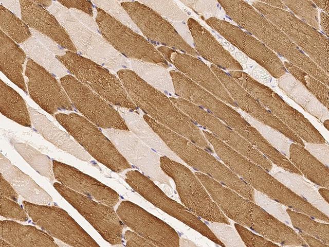 TNNC1 / Cardiac Troponin C Antibody - Immunochemical staining TNNC1 in human skeletal muscle with rabbit polyclonal antibody at 1:1000 dilution, formalin-fixed paraffin embedded sections.
