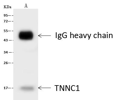 TNNC1 / Cardiac Troponin C Antibody - TNNC1 was immunoprecipitated using: Lane A: 0.5 mg HepG2 Whole Cell Lysate. 4 uL anti-TNNC1 rabbit polyclonal antibody and 60 ug of Immunomagnetic beads Protein A/G. Primary antibody: Anti-TNNC1 rabbit polyclonal antibody, at 1:100 dilution. Secondary antibody: Goat Anti-Rabbit IgG (H+L)/HRP at 1/10000 dilution. Developed using the ECL technique. Performed under reducing conditions. Predicted band size: 18 kDa. Observed band size: 16 kDa.