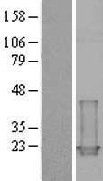 TNNC1 / Cardiac Troponin C Protein - Western validation with an anti-DDK antibody * L: Control HEK293 lysate R: Over-expression lysate