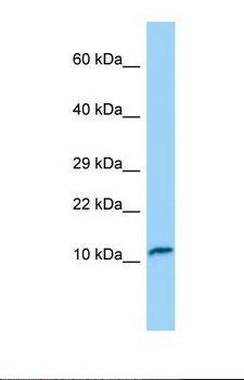 TNNC2 Antibody - Western blot of Human RPMI-8226. TNNC2 antibody dilution 1.0 ug/ml.  This image was taken for the unconjugated form of this product. Other forms have not been tested.