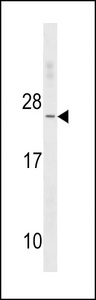 TNNC2 Antibody - TNNC2 Antibody western blot of K562 cell line lysates (35 ug/lane). The TNNC2 antibody detected the TNNC2 protein (arrow).