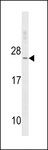 TNNC2 Antibody - TNNC2 Antibody western blot of K562 cell line lysates (35 ug/lane). The TNNC2 antibody detected the TNNC2 protein (arrow).