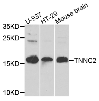 TNNC2 Antibody - Western blot analysis of extracts of various cells.