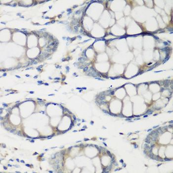 TNNC2 Antibody - Immunohistochemistry of paraffin-embedded human colon tissue.