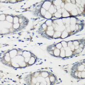 TNNC2 Antibody - Immunohistochemistry of paraffin-embedded human colon tissue.