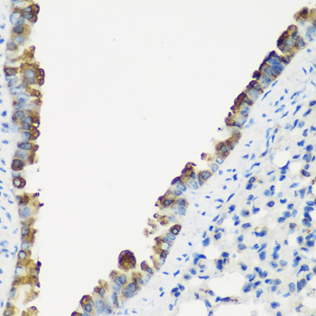 TNNC2 Antibody - Immunohistochemistry of paraffin-embedded mouse lung tissue.