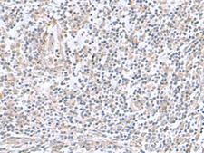 TNNC2 Antibody - Immunohistochemistry of paraffin-embedded Human tonsil tissue  using TNNC2 Polyclonal Antibody at dilution of 1:50(×200)