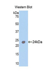 TNNI1 Antibody - Western blot of recombinant TNNI1.  This image was taken for the unconjugated form of this product. Other forms have not been tested.