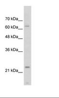 TNNI1 Antibody - Jurkat Cell Lysate.  This image was taken for the unconjugated form of this product. Other forms have not been tested.