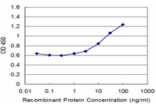 TNNI1 Antibody - Detection limit for recombinant GST tagged TNNI1 is approximately 1 ng/ml as a capture antibody.