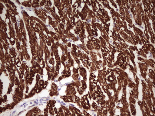 TNNI1 Antibody - Immunohistochemical staining of paraffin-embedded Human adult heart tissue using anti-TNNI1 mouse monoclonal antibody. (Heat-induced epitope retrieval by 1 mM EDTA in 10mM Tris, pH8.5, 120C for 3min,