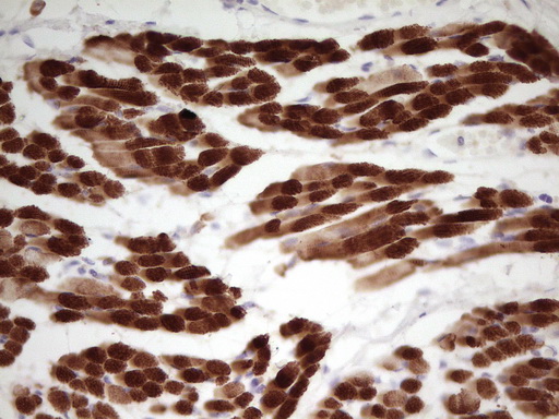 TNNI1 Antibody - Immunohistochemical staining of paraffin-embedded Human muscle tissue using anti-TNNI1 mouse monoclonal antibody. (Heat-induced epitope retrieval by 1 mM EDTA in 10mM Tris, pH8.5, 120C for 3min,