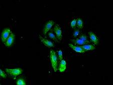 TNNI1 Antibody - Immunofluorescent analysis of HepG2 cells using TNNI1 Antibody at a dilution of 1:100 and Alexa Fluor 488-congugated AffiniPure Goat Anti-Rabbit IgG(H+L)