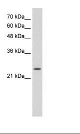 TNNI1 Antibody - HepG2 Cell Lysate.  This image was taken for the unconjugated form of this product. Other forms have not been tested.
