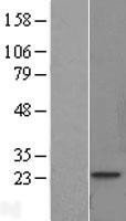 TNNI1 Protein - Western validation with an anti-DDK antibody * L: Control HEK293 lysate R: Over-expression lysate