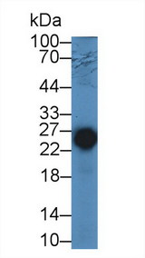 TNNI2 Antibody