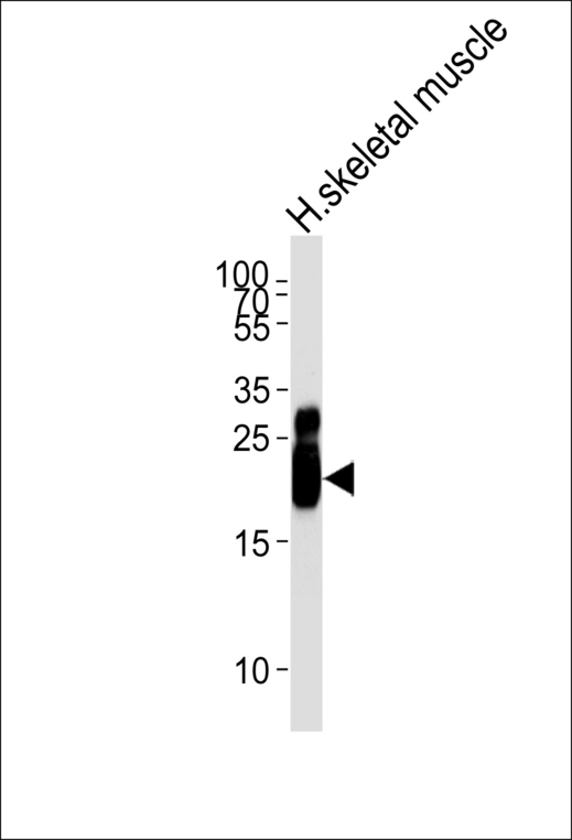 TNNI2 Antibody - Western blot of lysate from human skeletal muscle tissue lysate, using TNNI2 Antibody. Antibody was diluted at 1:1000 at each lane. A goat anti-rabbit IgG H&L (HRP) at 1:5000 dilution was used as the secondary antibody. Lysate at 35ug per lane.
