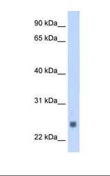 TNNI2 Antibody - Fetal muscle cell lysate. Antibody concentration: 1.25 ug/ml. Gel concentration: 12%.  This image was taken for the unconjugated form of this product. Other forms have not been tested.