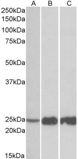 TNNI2 Antibody - TNNI2 antibody (0.03 ug/ml) staining of Human (A), Mouse(B) and Rat (C) Skeletal Muscle lysate (35 ug protein in RIPA buffer). Primary incubation was 1 hour. Detected by chemiluminescence.
