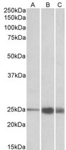 TNNI2 Antibody - TNNI2 antibody (1 ug/ml) staining of Human (A), Mouse(B) and Rat (C) Skeletal Muscle lysate (35 ug protein in RIPA buffer). Primary incubation was 1 hour. Detected by chemiluminescence.